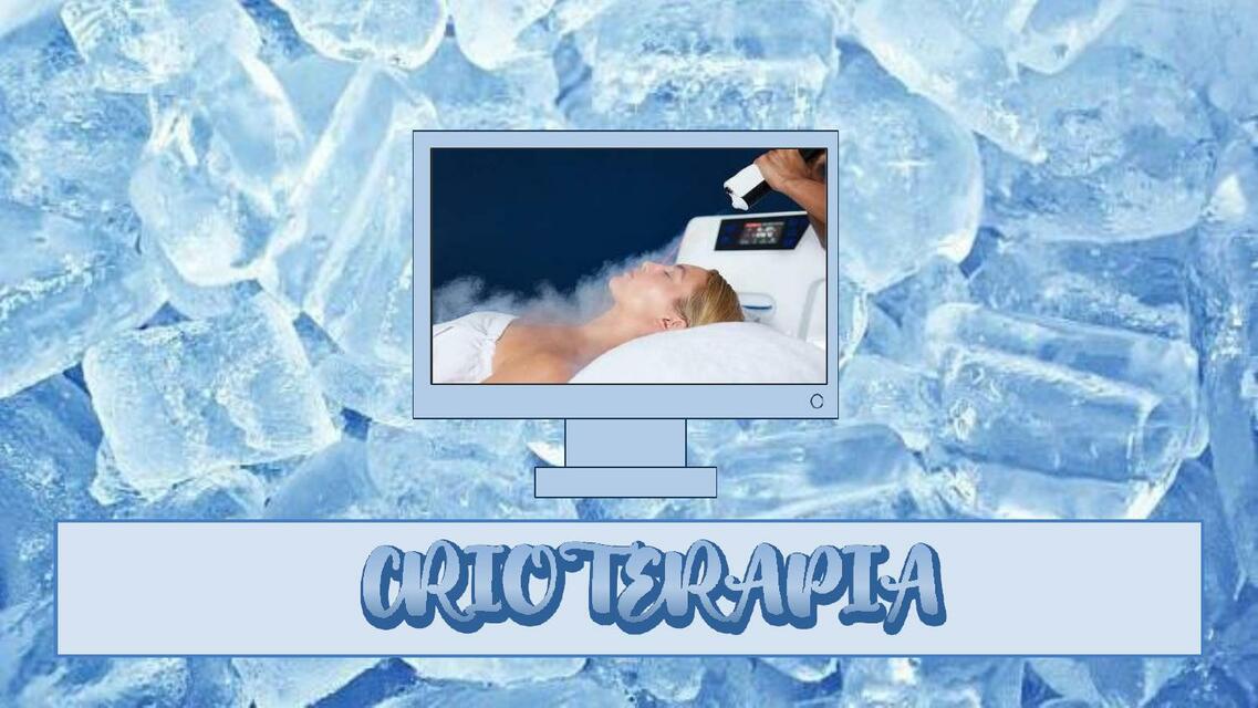 Crioterapia 