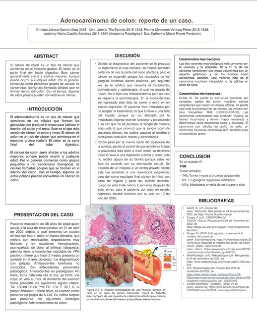 Adenocarcinoma de colon: Reporte de un caso