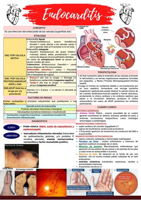 ENDOCARDITIS