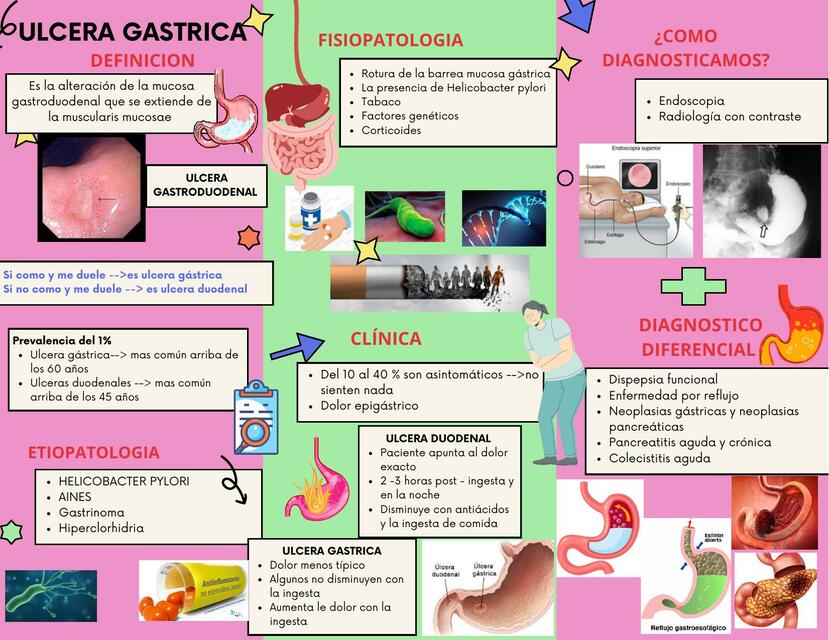 ULCERA GASTRICA
