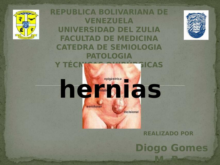 Hernia eventración y evisceración