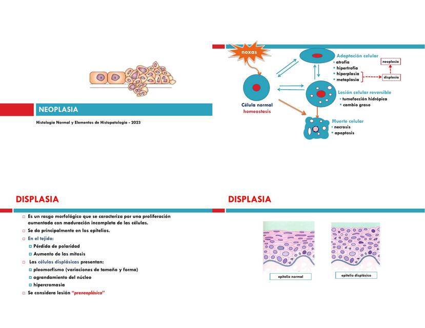 Inflamación y neoplasia