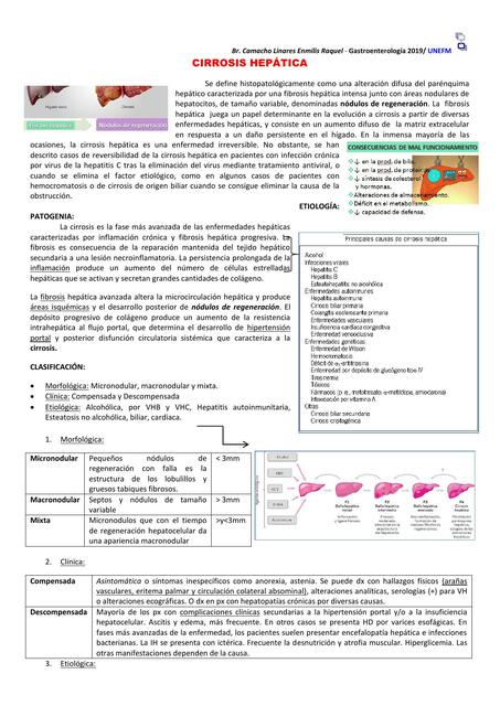 Cirrosis hepática