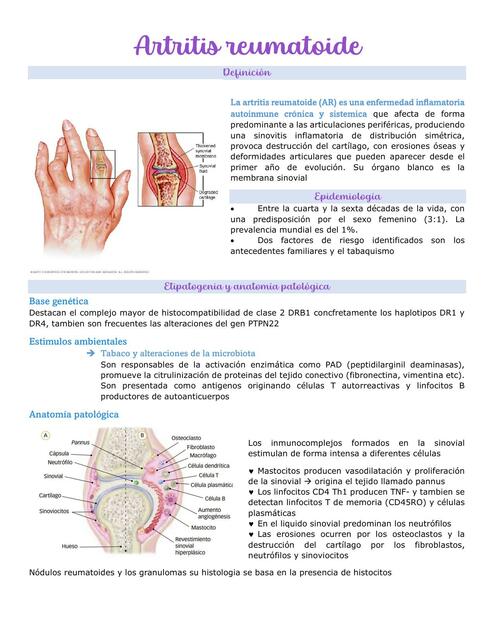 Artritis Reumatoide 