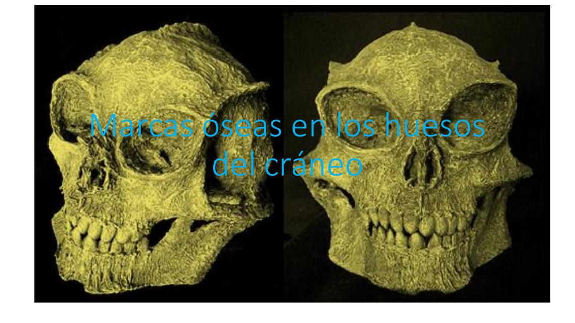 6 marcas del cráneo