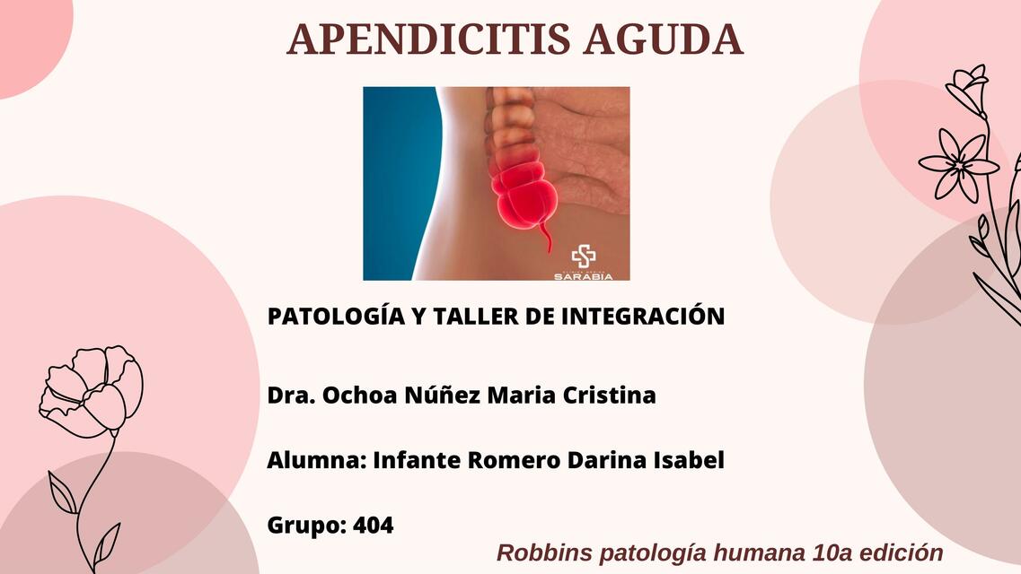 Apendicitis Aguda 