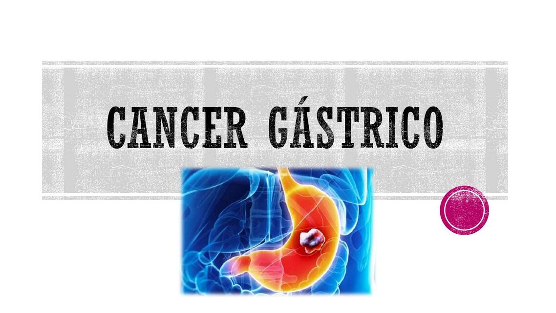 Cáncer Gástrico  