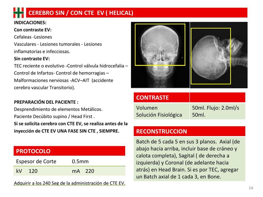 Cerebro Sin/Con CTE EV (Helical)