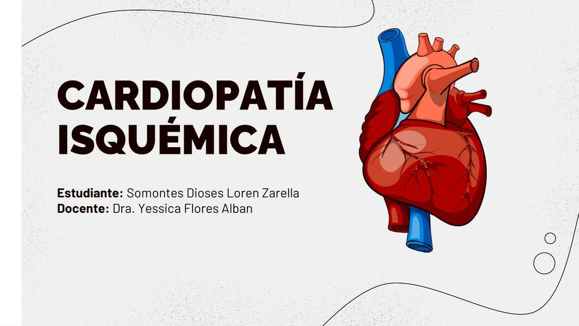 Cardiopatía Isquémica