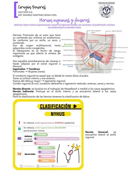 Heria inguinal femoral 