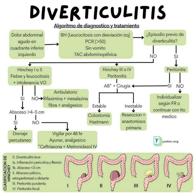 Diverticulitis | YUDOC.ORG | uDocz