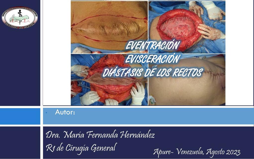 Eventración Evisceración y Diastásis de los rectos