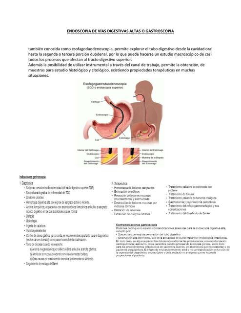 Endoscopia de Vías Digestivas Altas o Gastroscopia 