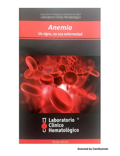 Anemia 