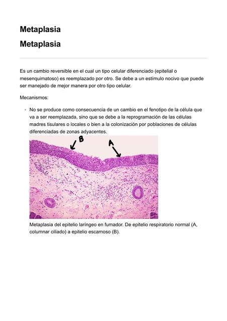 Metaplasia