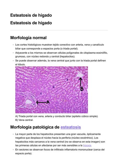 Esteatosis de hígado