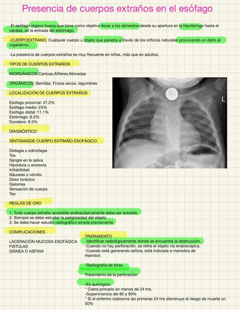Cuerpos Extraños en el esófago 
