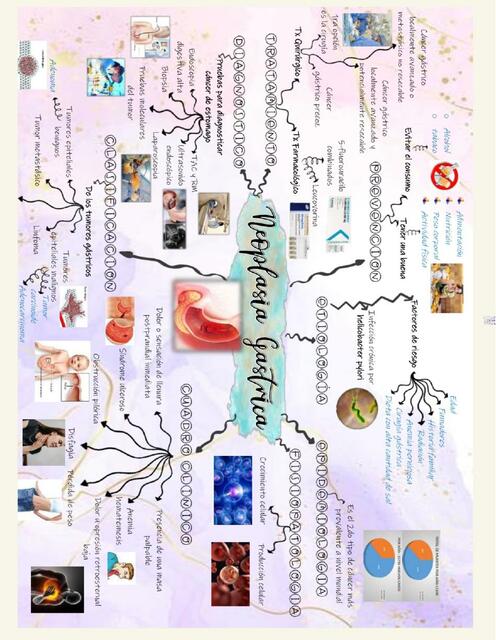 Neoplasia Gástrica