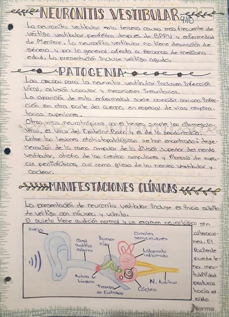 Neuronitis NEURONITIS VESTIBULAR | Cinthia Martínez | uDocz
