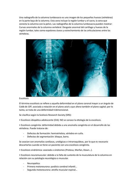 Columna Lumbosacra