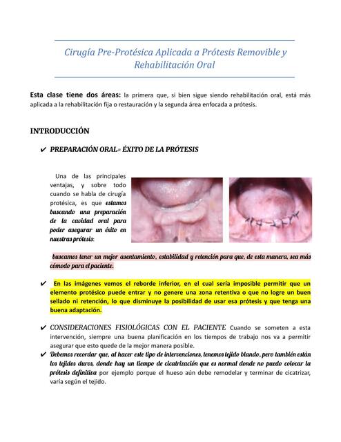 Cirugía pre protésica a prótesis removible y rehabilitación oral 