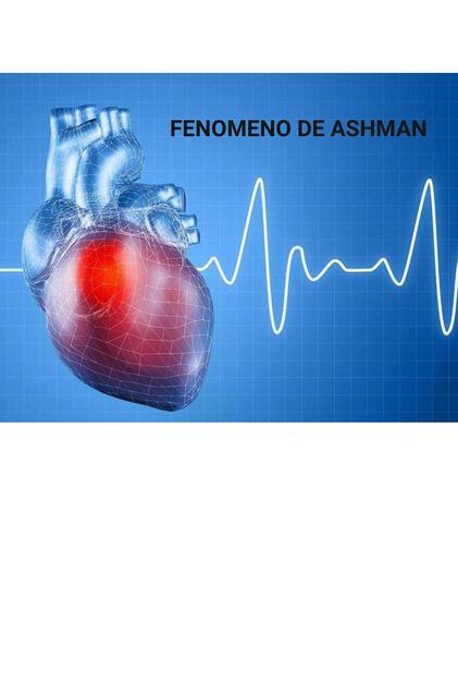 ¿Que es el Fenómeno de Ashman?