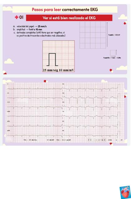 Pasos para leer correctamente un EKG