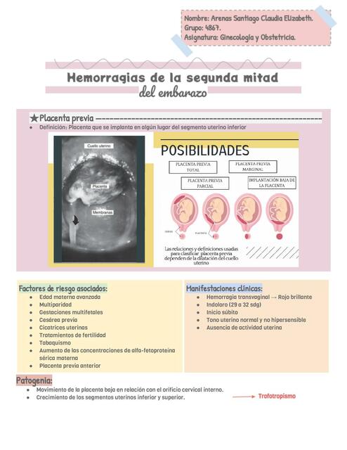 Hemorragias del segundo trimestre del embarazo