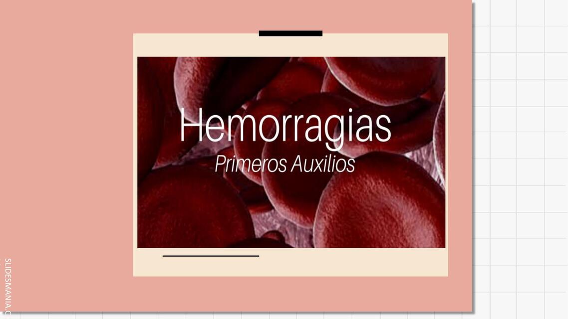 Hemorragias 