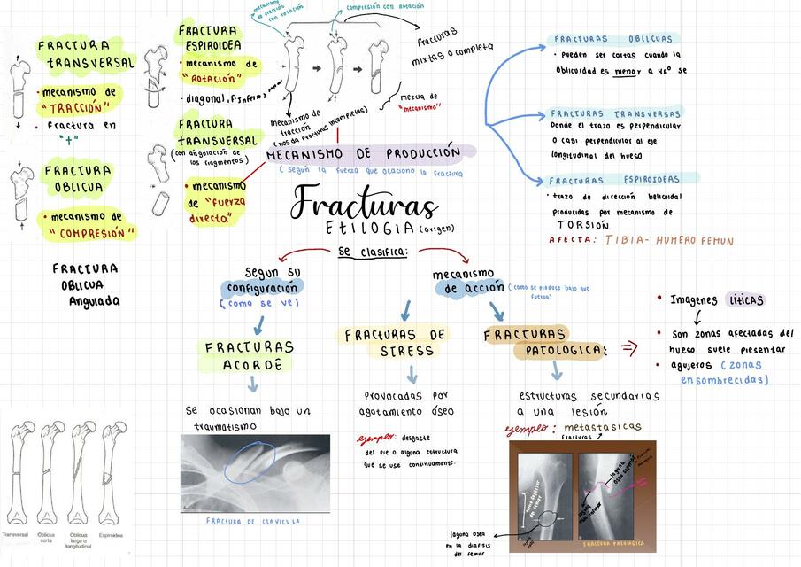 Fracturas en radiologia parte 2