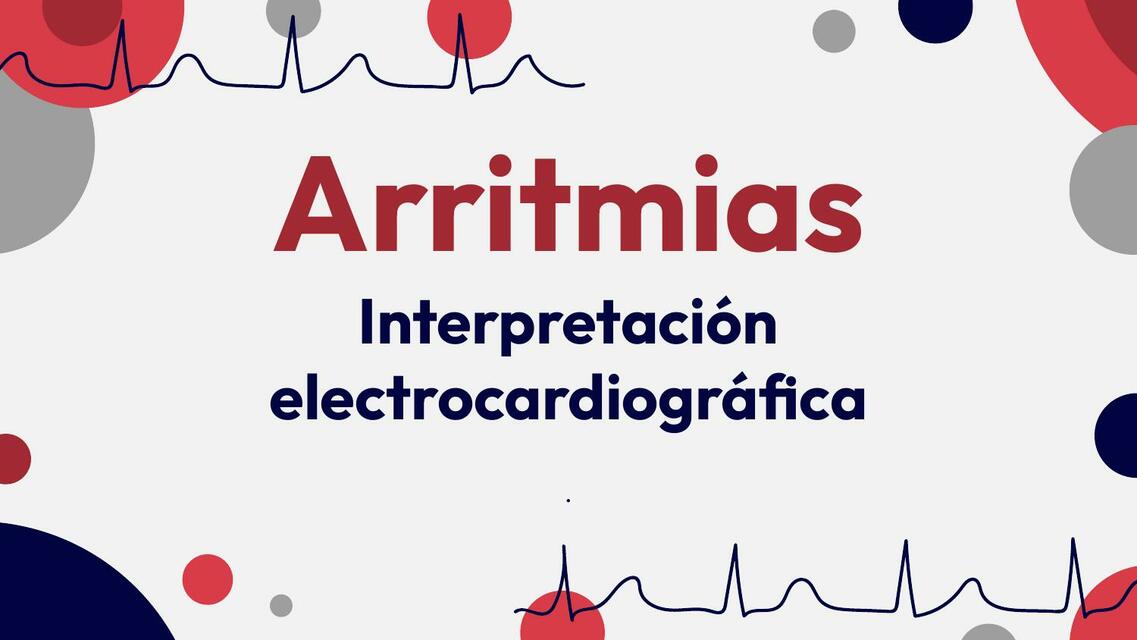 Arritmias: Interpretación electrocardiográfica