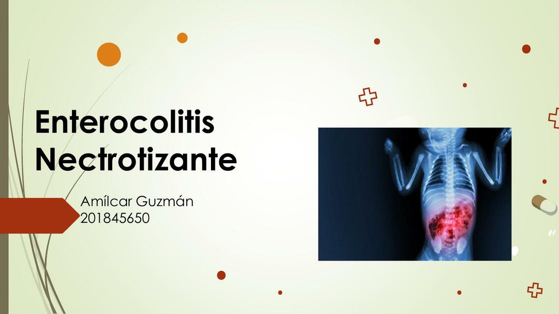 Enterocolitis Necrotizante 