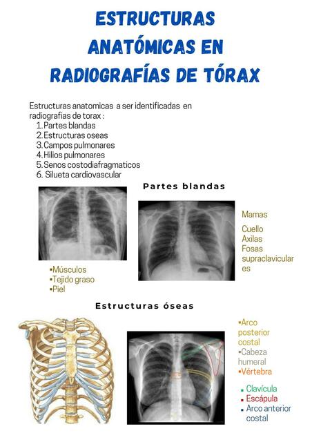 SIGNOS RADIOLÓGICOS