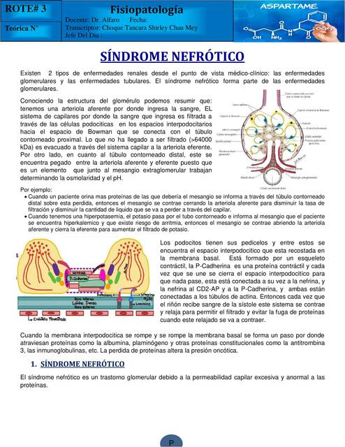 Síndrome nefrótico