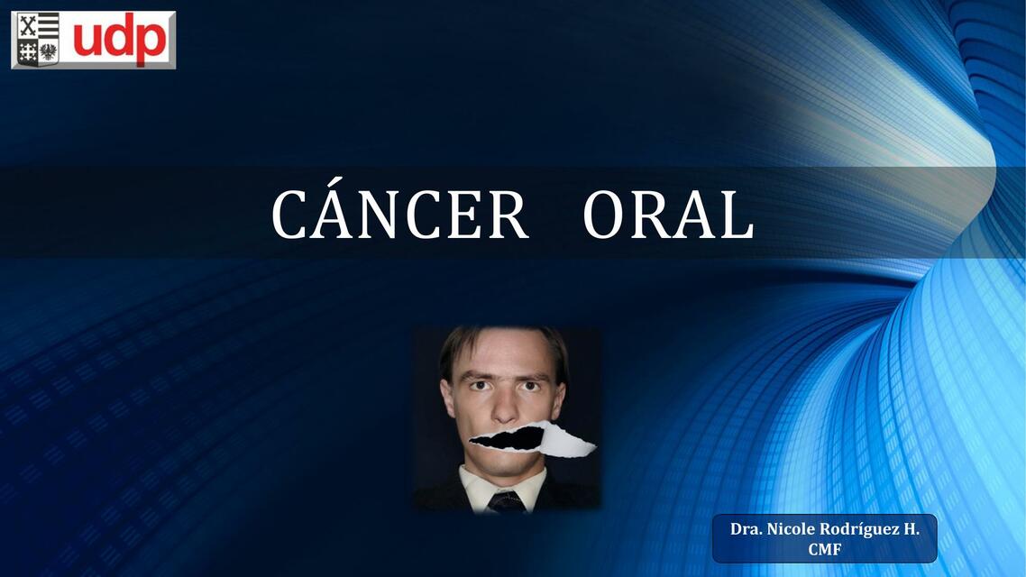 CLASE V CANCER ORAL UDP