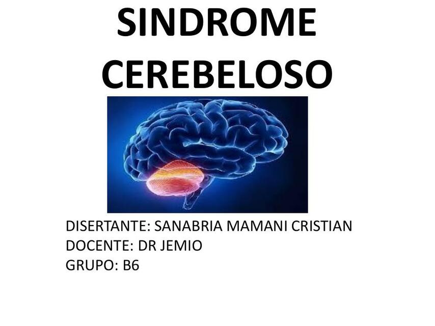 SINDROMES CEREBELOSO