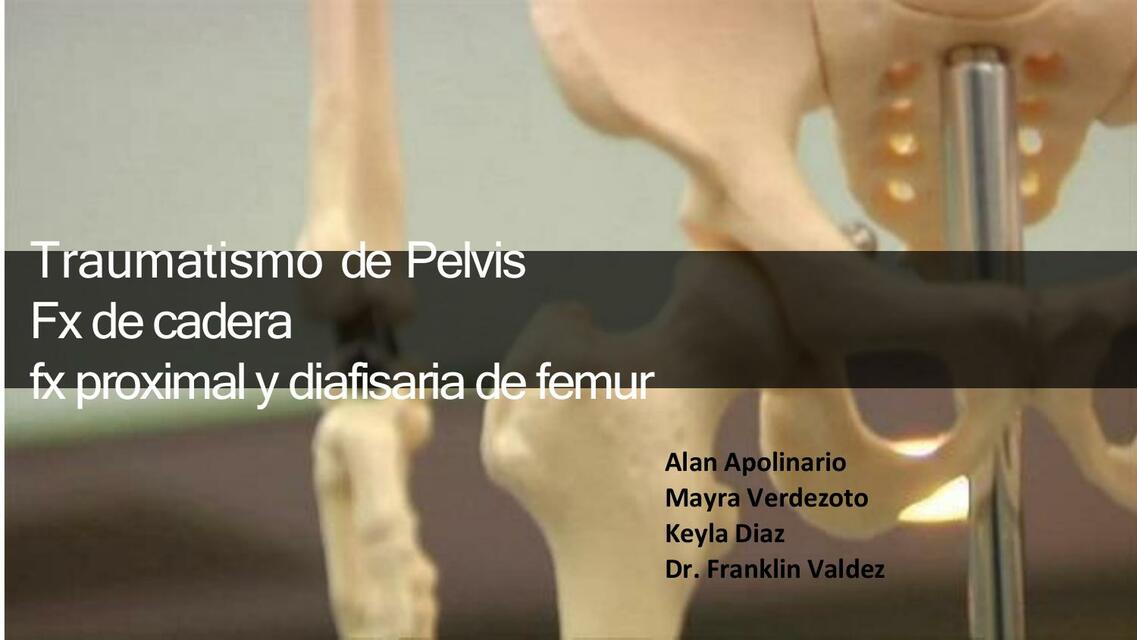 TRAUMA DE PELVIS EXPO