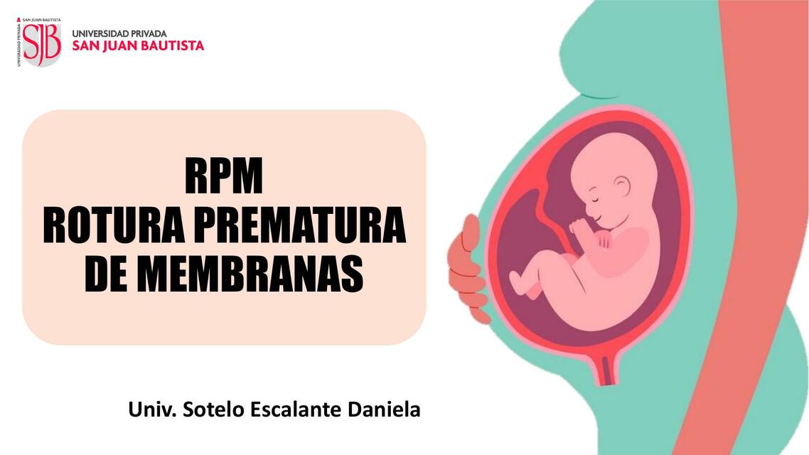 RPM Rotura prematura de membranas 