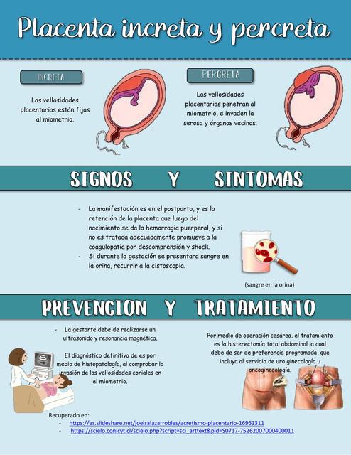 Placenta increta y percreta | Ximena Luciana Tolentino Huaman | uDocz