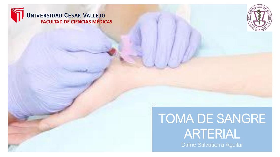 Toma de sangre arterial