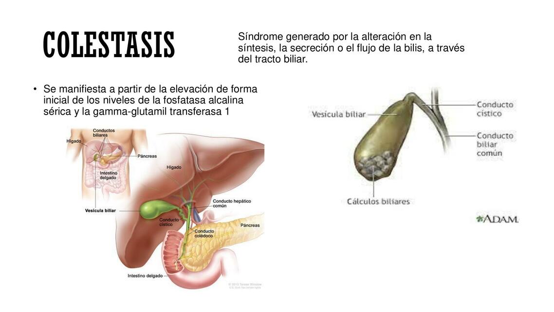 colestasis