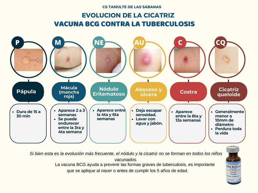 Cicatrización vacuna BCG