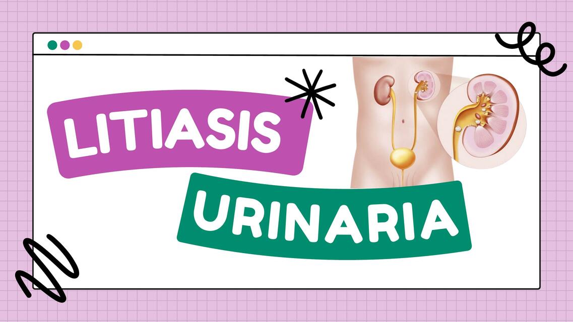 Litiasis renal 