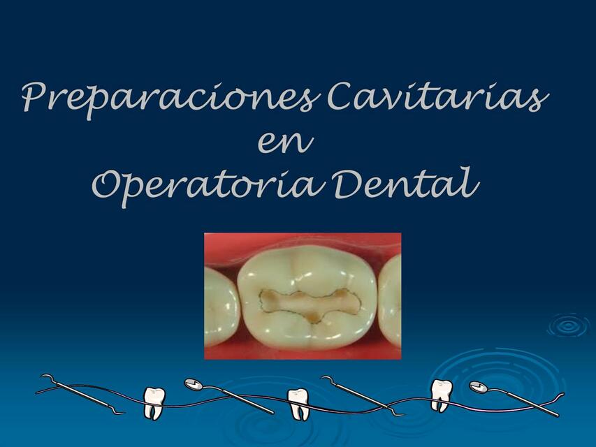 Preparación Cavitarias en Operatoria Dental