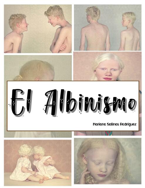 El Albinismo Embriología