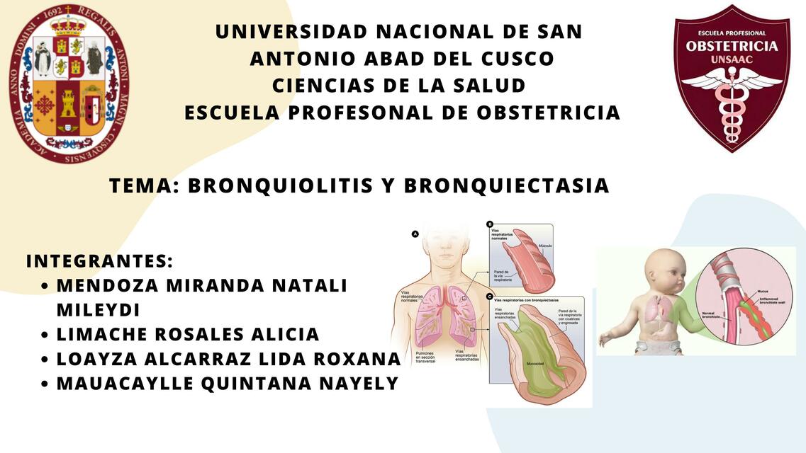 Bronquiectasia