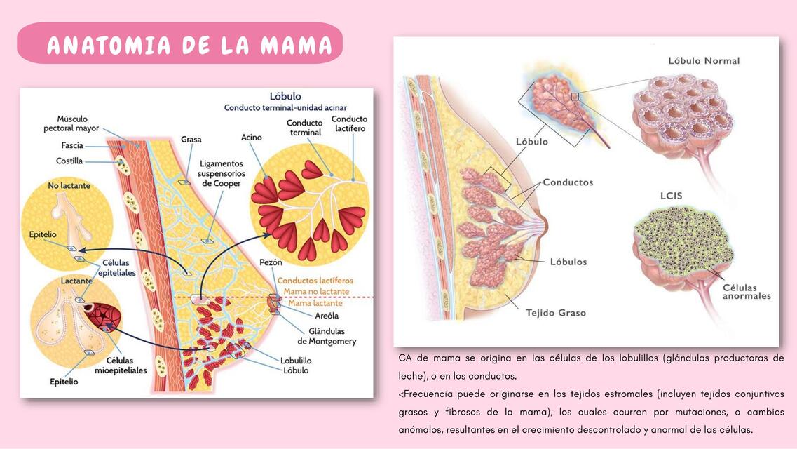 Cancer de Mama