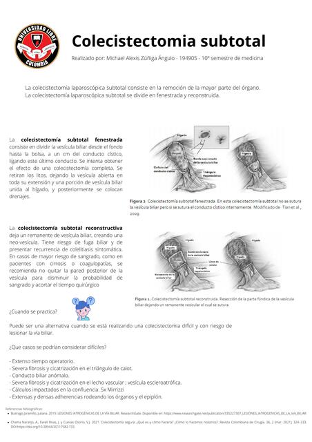 Colecistectomia subtotal