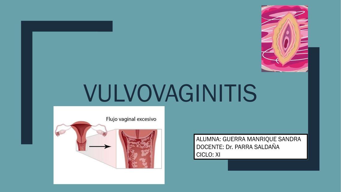 VULVOVAGINITIS