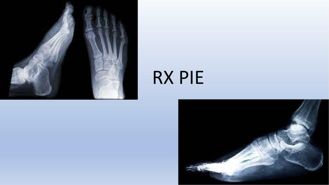 Radiología del pie